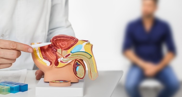 Prostate Treatments