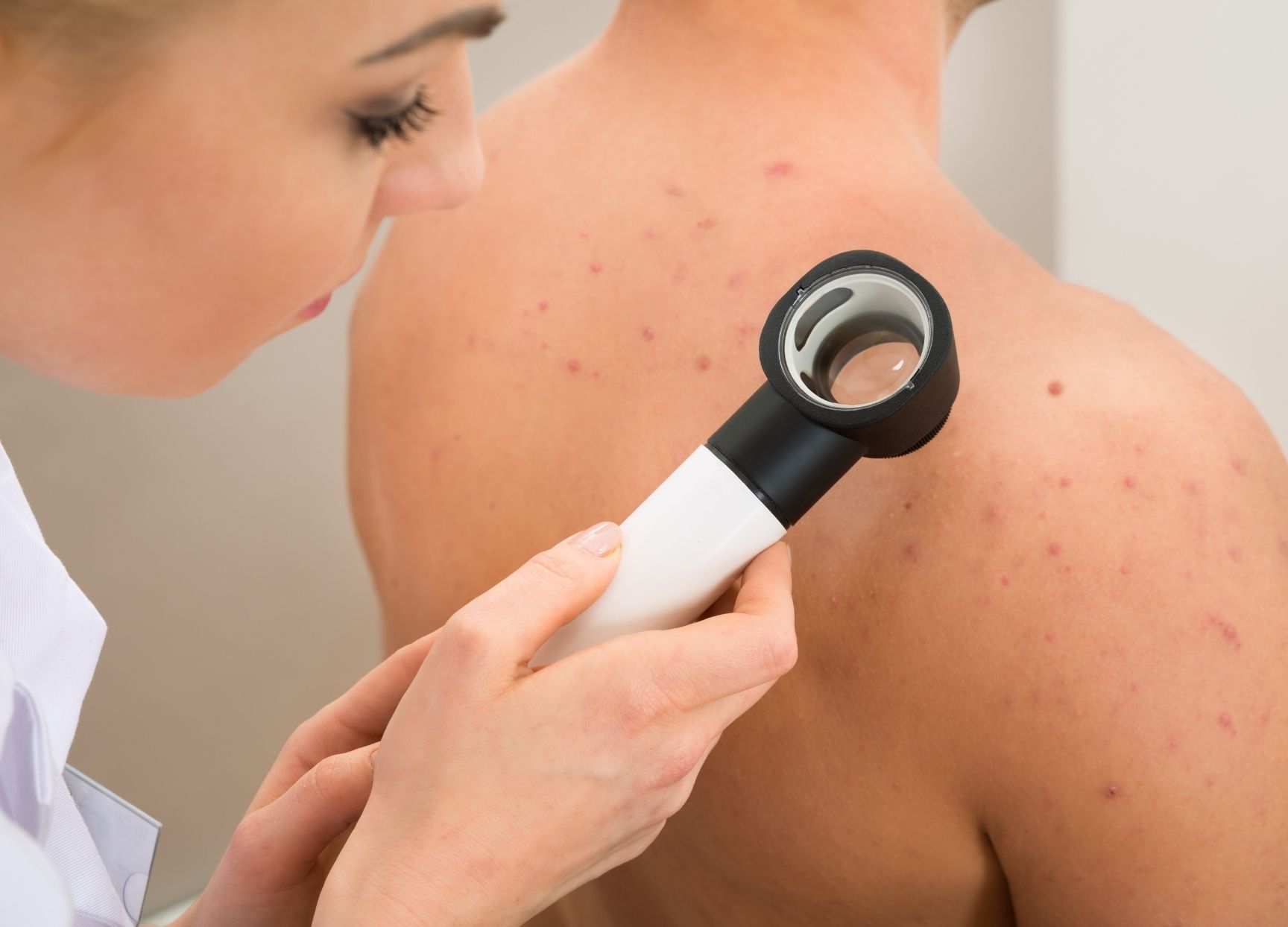 Top tips for moles: what to be aware of and when to take action