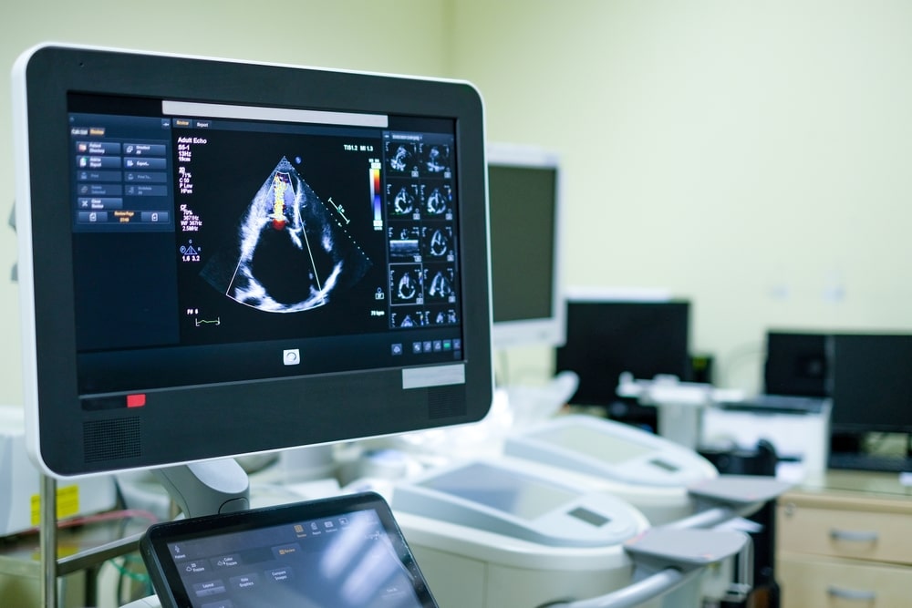 Private echocardiogram scanner at OneWelbeck
