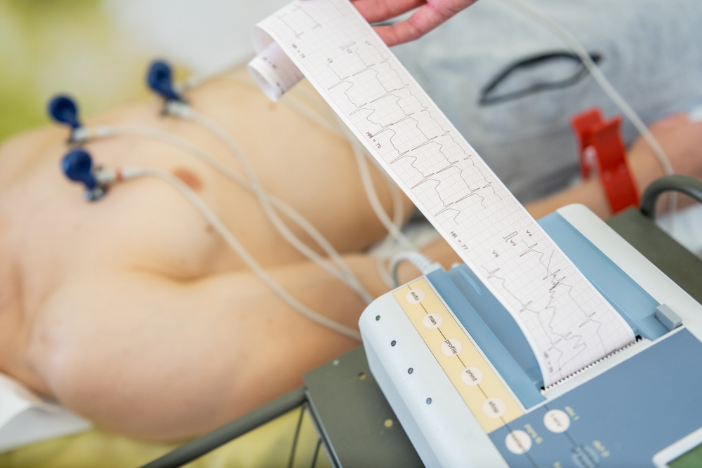 private ECG test