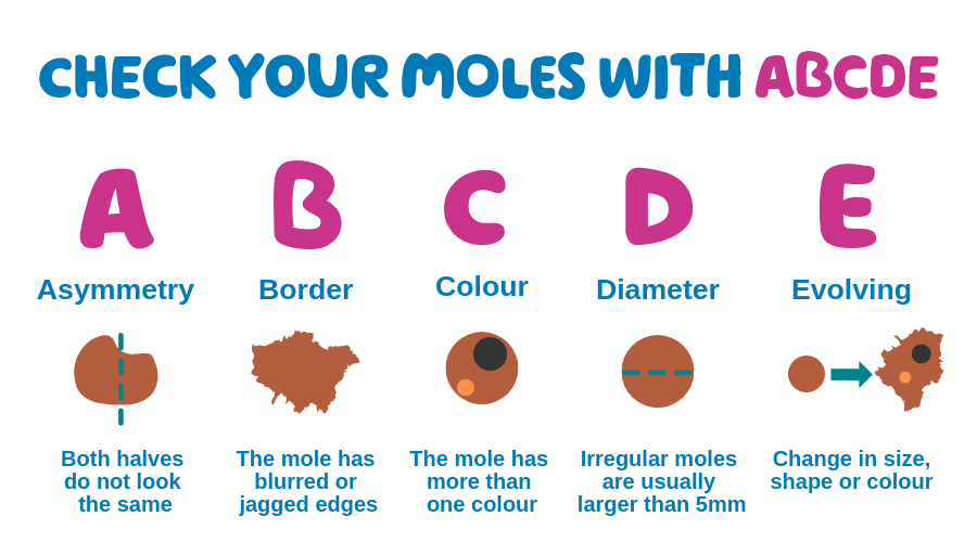 check moles ABCDE