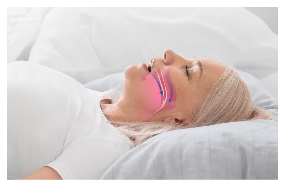 Blocked nasal airways causing snoring