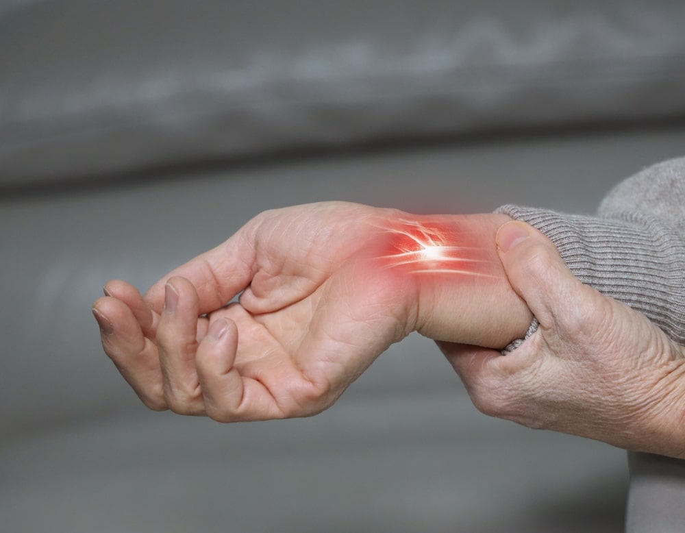 Carpal tunnel syndrome wrist pain