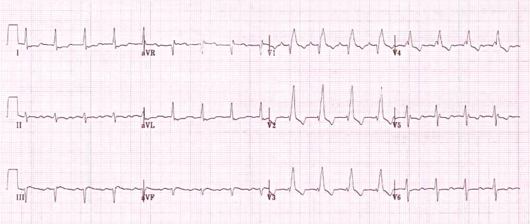 When to Worry About Heart Palpitations and See a Doctor