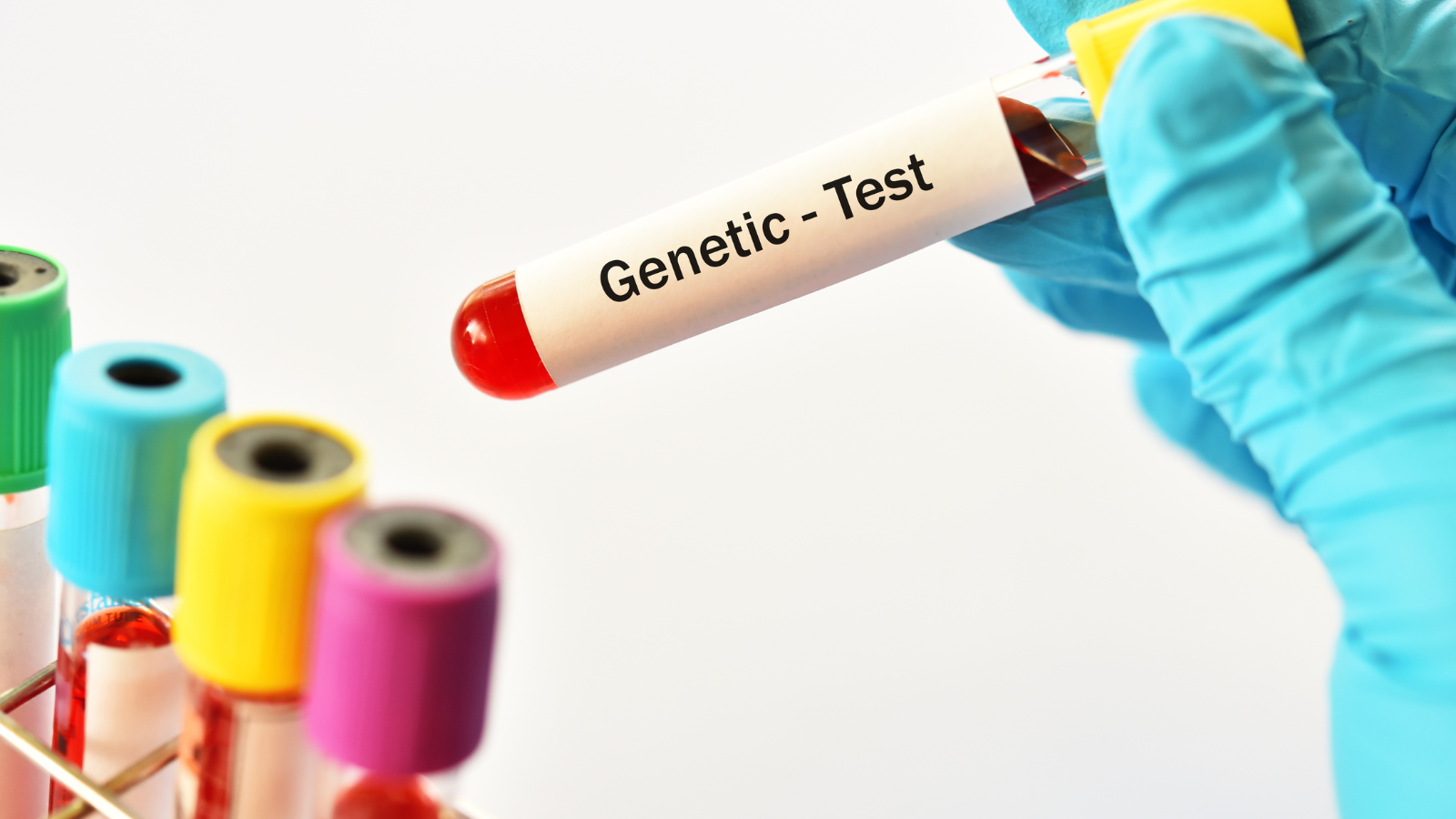 Genetics Testing at OneWelbeck