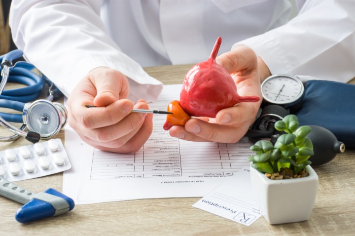 Prostate Tests