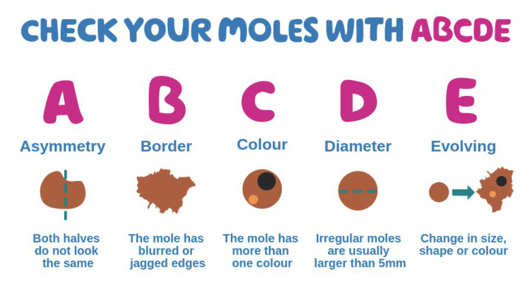 How to check your moles infographic - OneWelbeck